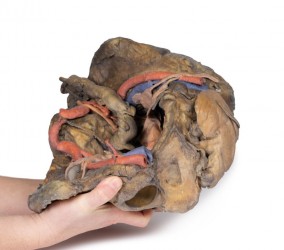 Model anatomiczny miednicy żeńskiej (struktury głębokie) - Image no.: 5