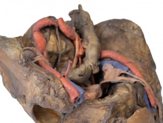 Model anatomiczny miednicy żeńskiej (struktury głębokie) - Image no.: 8