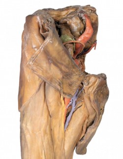Model anatomiczny męskiej miednicy i uda - Image no.: 3
