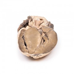Model anatomiczny podzastawkowego zwężenia aorty - Image no.: 1