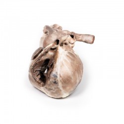 Model anatomiczny serca - Tetralogia Fallota - Image no.: 1