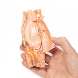 Model anatomiczny urazu przetoki przełykowo-aortalnej - Image no.: 4