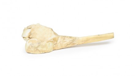Model anatomiczny kostniakomięsaka kości udowej - Image no.: 2