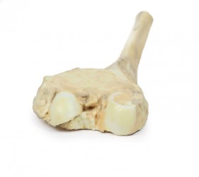 Model anatomiczny kostniakomięsaka kości udowej - Image no.: 3