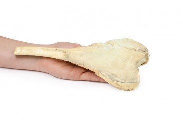 Model anatomiczny kostniakomięsaka kości udowej - Image no.: 4