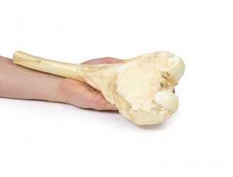 Model anatomiczny kostniakomięsaka kości udowej - Image no.: 5