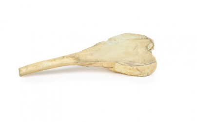 Model anatomiczny kostniakomięsaka kości udowej - Image no.: 1