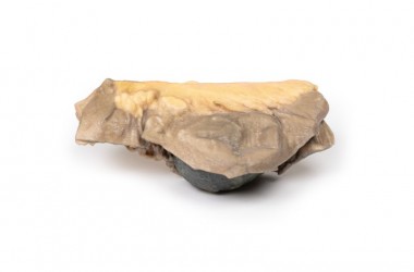 Model anatomiczny niedrożności jelit wywołanej kamieniem żółciowym - Image no.: 2