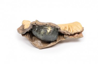 Model anatomiczny niedrożności jelit wywołanej kamieniem żółciowym - Image no.: 1