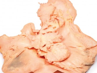 Model anatomiczny gruczolakoraka żołądka - Image no.: 3