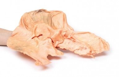 Model anatomiczny gruczolakoraka żołądka - Image no.: 5