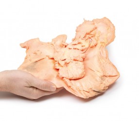 Model anatomiczny gruczolakoraka żołądka - Image no.: 6