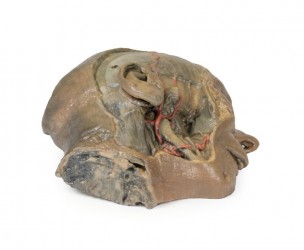 Model przekroju strzałkowego głowy z dyssekcją dołu podskroniowego - Image no.: 5