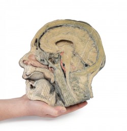 Model przekroju strzałkowego głowy z dyssekcją dołu podskroniowego - Image no.: 6