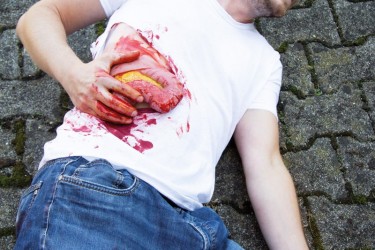 Model rany - wypadnięcie jelita grubego po uszkodzeniu ściany brzucha - Image no.: 4