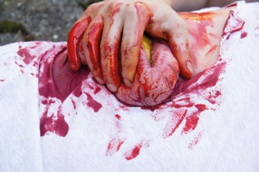 Model rany - wypadnięcie jelita grubego po uszkodzeniu ściany brzucha - Image no.: 6