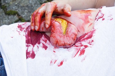 Model rany - wypadnięcie jelita grubego po uszkodzeniu ściany brzucha - Image no.: 7