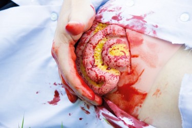 Model rany - wypadnięcie jelita cieńkiego po uszkodzeniu ściany brzucha - Image no.: 8