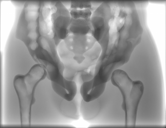 Fantom torsu do RTG/CT i MRI - Image no.: 4