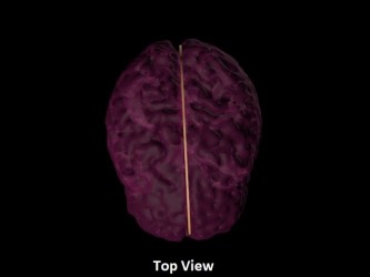 Sierp mózgu do USG, MRI - Image no.: 2