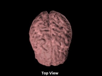 Miąższ mózgu USG, MRI i CT - Image no.: 2