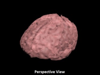 Miąższ mózgu USG, MRI i CT - Image no.: 3