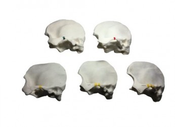 Modele kości skroniowej do USG, MRI i CT - Image no.: 1