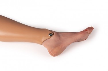 Model stopy cukrzycowej, ciężkie stadium choroby, wersja manekin - Image no.: 4