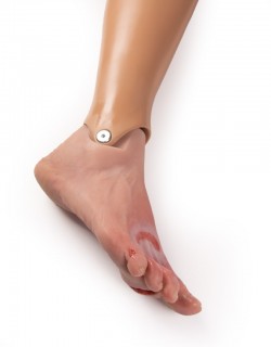 Model stopy cukrzycowej, ciężkie stadium choroby, wersja manekin - Image no.: 6
