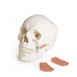 Dentystyczny model czaszki z TMD, 8 części - Image no.: 4