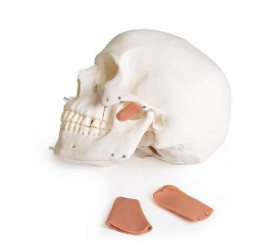 Dentystyczny model czaszki z TMD, 8 części - Image no.: 5