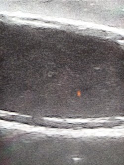 Fantom psa do diagnostyki ultrasonograficznej pęcherza moczowego - Image no.: 2