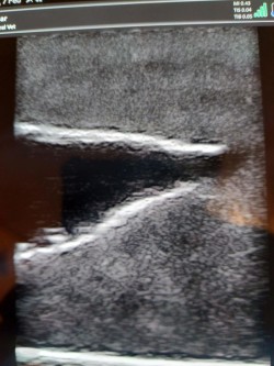 Fantom psa do diagnostyki ultrasonograficznej pęcherza moczowego - Image no.: 3