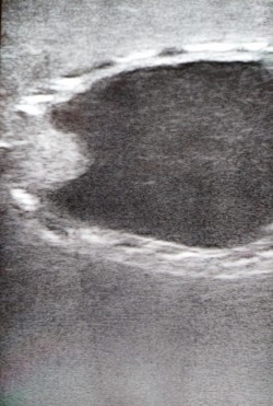 Fantom psa do diagnostyki ultrasonograficznej pęcherza moczowego - Image no.: 6